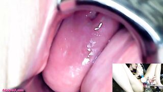 AdalynnX - Endoscope Speculum Hitachi Vibrator Cum