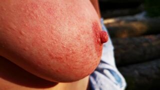 Nettle Punishment Day - Ass, tits and vagina in public - DC