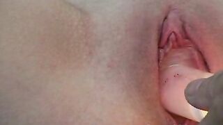 Punishing the Patient